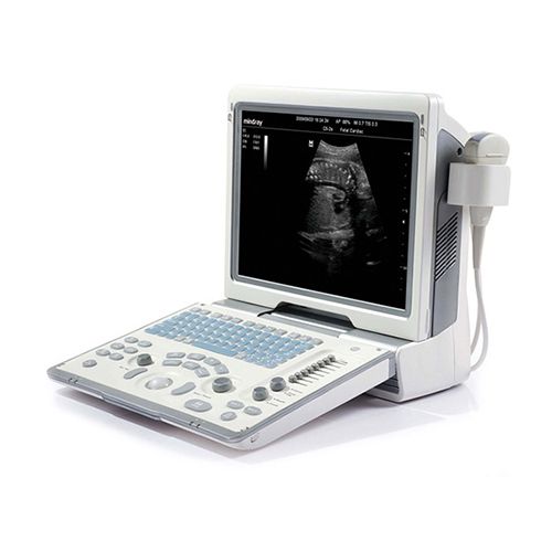 Ultrasonograf DP50 (Mindray)